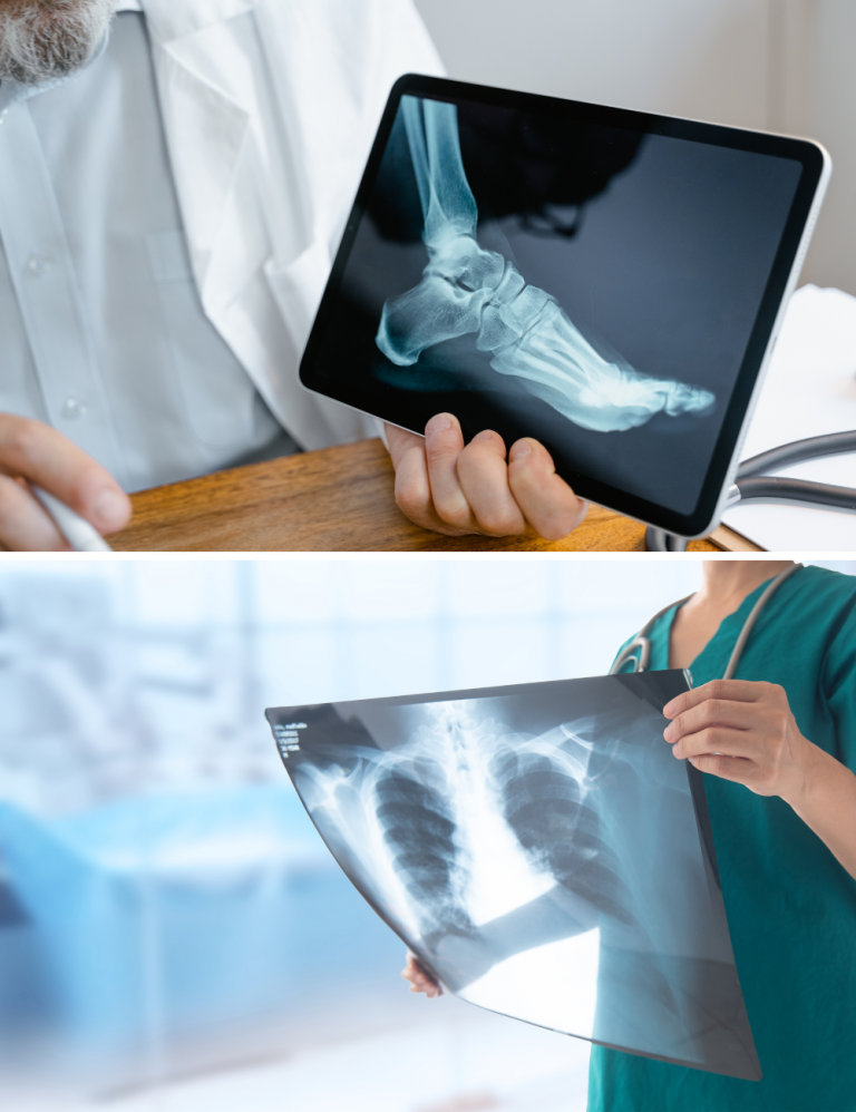 Digitális röntgendiagnosztika és vizsgálat